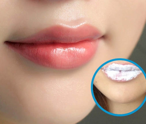 Khử thâm môi là gì? Khử thâm môi và phun môi khác nhau ở điểm nào?